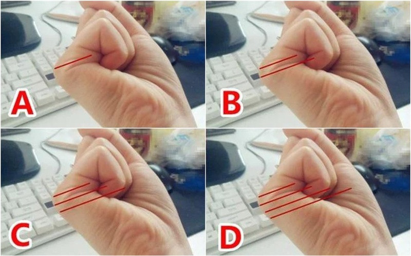 Có 3 đường chỉ. Những người có đặc điểm này thường sôi nổi, hào phóng, có khả năng lãnh đạo, nhưng bạn lại rất cứng nhắc, cố chấp, thích áp đặt suy nghĩ của mình cho người khác. Vận trình công việc của bạn khá hanh thông, nhưng nếu muốn thực sự giàu có thì bạn nên đầu tư kinh doanh, buôn bán. Ban đầu, bạn khó tránh khỏi những khó khăn, trở ngại, thậm chí bị tiểu nhân gài bẫy hãm hại. Tuy nhiên, sau tuổi 30, sự nghiệp của bạn sẽ ngày càng ổn định, thu nhập tăng lên vèo vèo, được hưởng cuộc sống sung túc, đủ đầy. 