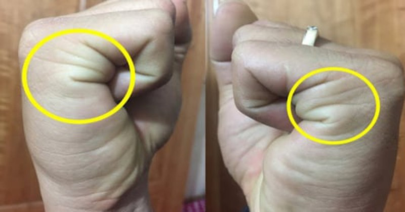 Có 2 đường chỉ. Theo thuật xem đường chỉ tay, nếu bạn sở hữu 2 đường chỉ khi nắm bàn tay lại thì chứng tỏ bạn là người siêng năng, hòa đồng, khéo ăn khéo nói, dễ thích nghi với môi trường mới và được nhiều người yêu quý. Bạn cũng là người ngay thẳng, ghét a dua nịnh nọt, nhưng làm việc hơi rập khuôn, máy móc.