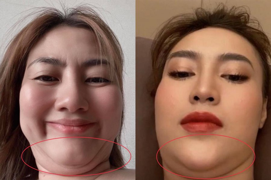 Phụ nữ có 4 nét dị tướng này, sau 35 giàu sang phú quý phát hờn - Hình 2 Phu nu co 4 net di tuong nay, sau 35 giau sang phu quy phat hon-Hinh-2