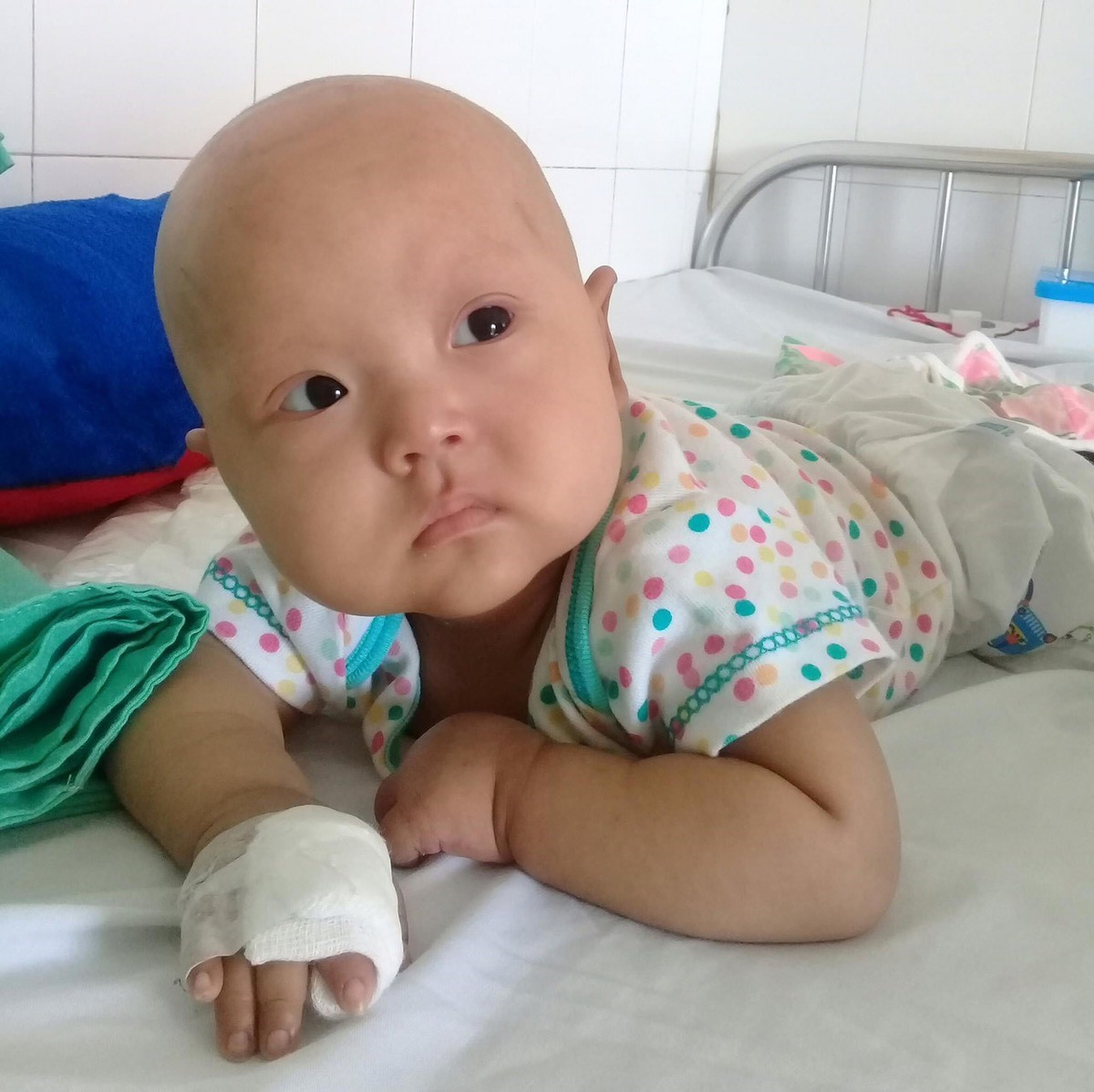 Xot xa be gai 2 tuoi hoai tu ngon tay do mac benh ung thu