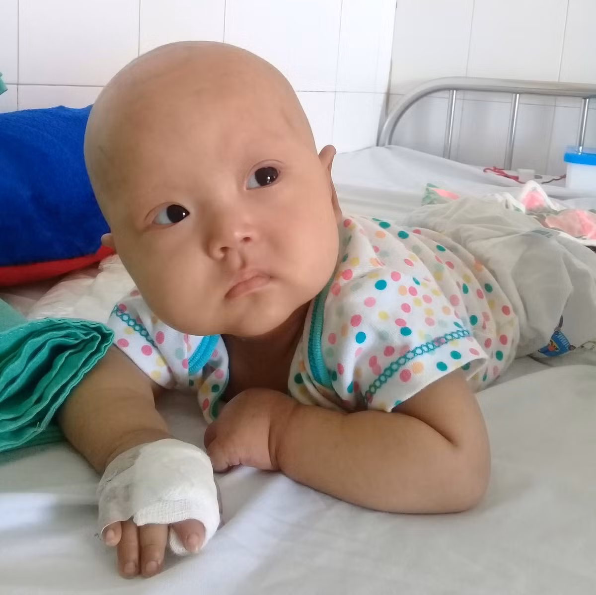 Xot xa be gai 2 tuoi hoai tu ngon tay do mac benh ung thu