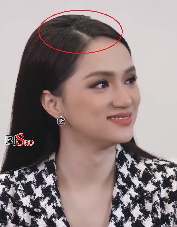 Mặc dù giữ được gương mặt trẻ đẹp, song Hương Giang khó thay đổi được dấu hiệu tự nhiên này. Nhiều người hâm mộ không khỏi xót xa trước mái tóc điểm nhiều sợi bạc của hoa hậu, bởi cô mới chớm sang tuổi 30.