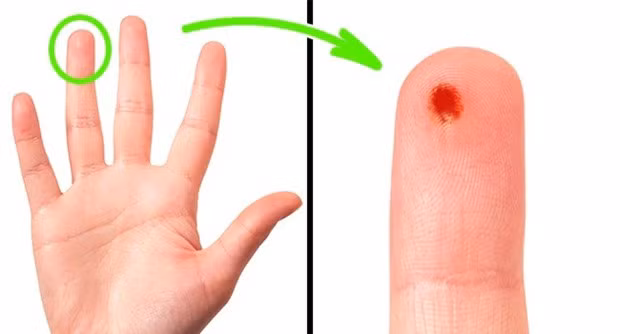 8. Tại sao khi lấy máu để thử chỉ lấy ở ngón áp út. Vì ngón cái và ngón út là 2 ngón có mạch máu nối đến toàn bộ mạng lưới ở cổ tay, cho nên các bác sỹ đều khuyến nghị không "động chạm" gì đến 2 ngón đó. Nếu có sai sót lây truyền gì thì sẽ ảnh hưởng đến cả phần cánh tay của bạn. Ngoài ra, ngón áp út là ngón ít đau nhất.