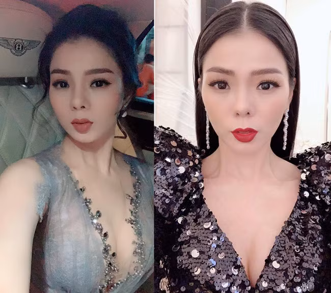 Đại diện của ca sĩ Lệ Quyên chia sẻ: "Ai cũng biết chị Lệ Quyên sửa mũi từ chục năm nay. Nhưng gần đây, mũi của chị bị sưng rất nặng. Lúc đầu chị còn nghĩ không sao, uống thuốc sẽ khỏi nhưng không phải."