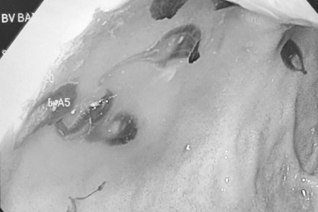 Nguoi dan ong nuoi hon 50 con san trong gan vi mon an nay