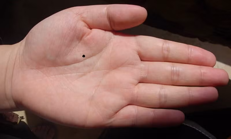 4 not ruoi tren co the phu nu bao hieu van so tot-Hinh-3