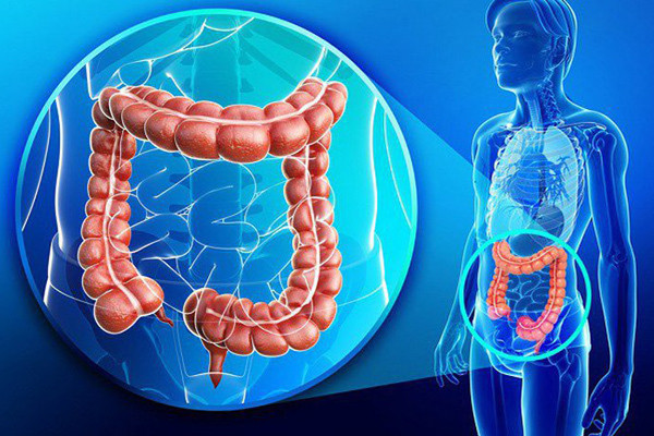 4 trieu chung tren co the canh bao ung thu dai trang-Hinh-4