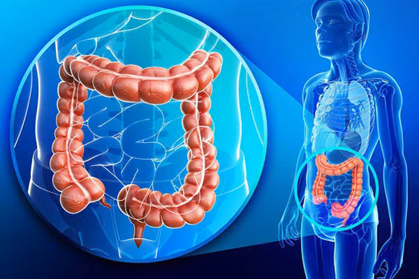 4 trieu chung tren co the canh bao ung thu dai trang-Hinh-4