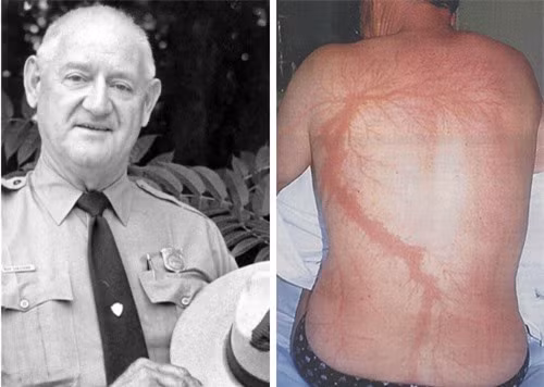 Nguoi dan ong bi set danh 7 lan lien tuc ma van song sot