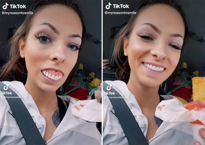 Co gai 24 tuoi thich khoe ham rang gia khien dan mang sung sot