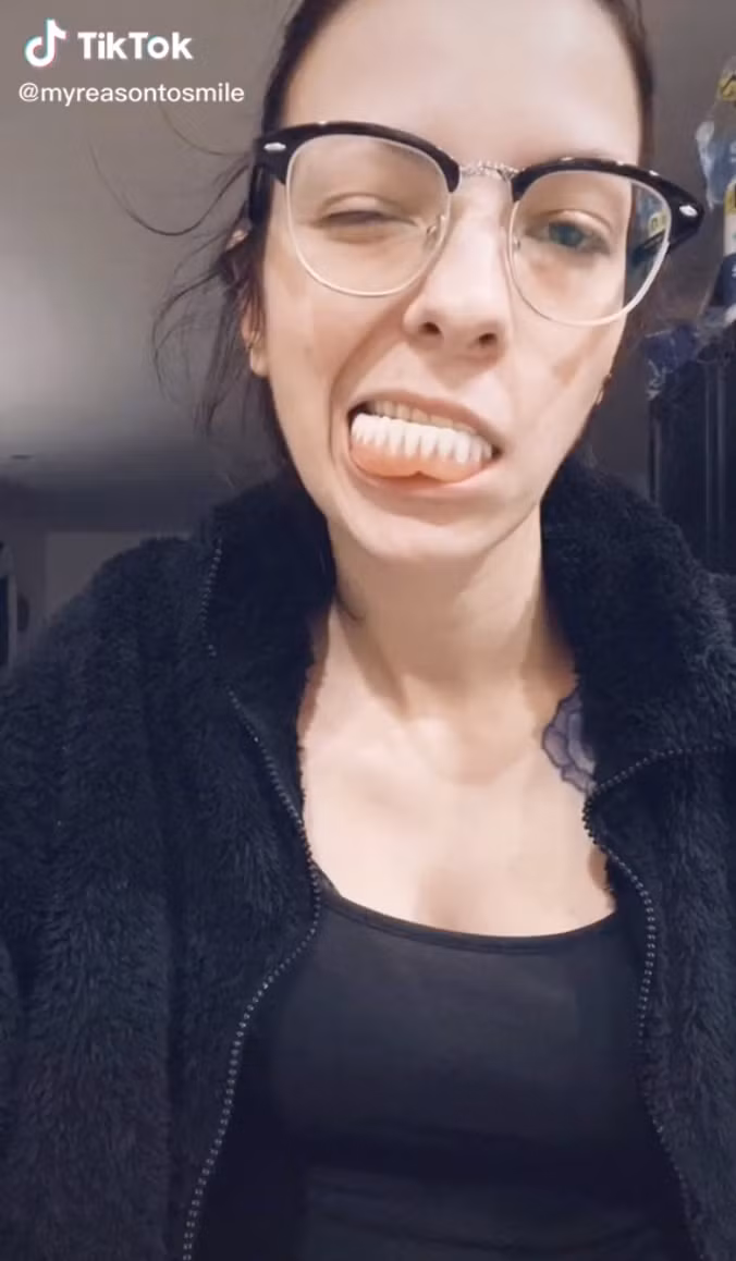 Co gai 24 tuoi thich khoe ham rang gia khien dan mang sung sot-Hinh-3