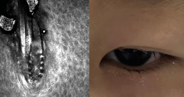 Be gai duoc dua den vien phat hien 21 con bo ve ky sinh tren mi