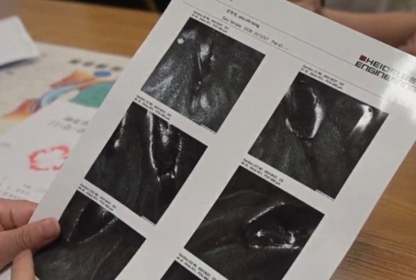 Be gai duoc dua den vien phat hien 21 con bo ve ky sinh tren mi-Hinh-2