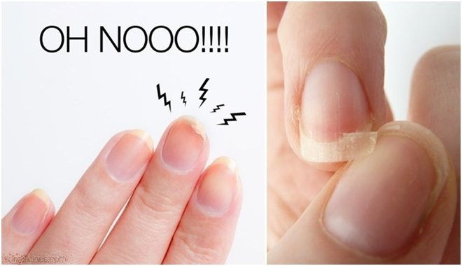 5 dau hieu bat thuong o ngon tay canh bao benh nguy hiem-Hinh-3