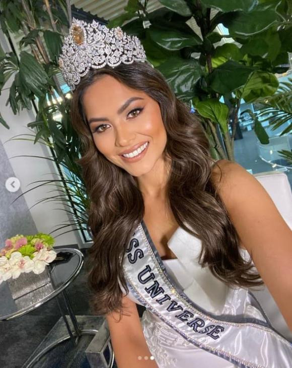 Tan Miss Universe khien dan tinh bat ngo vi vong hai ngan mo-Hinh-3