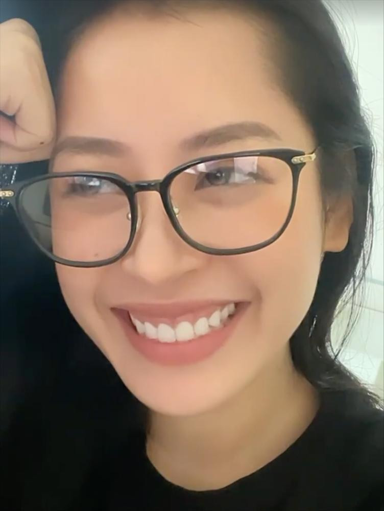 Khuyet diem de lo nhung it ai de y tren guong mat Chi Pu