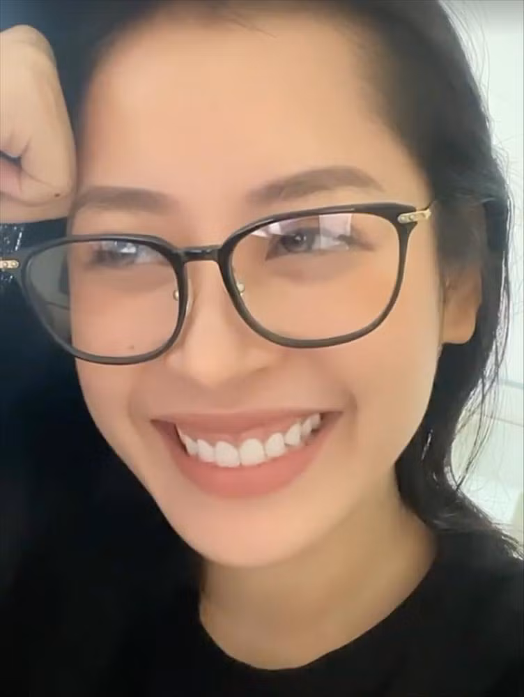 Khuyet diem de lo nhung it ai de y tren guong mat Chi Pu