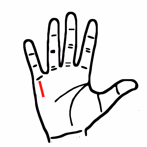 Ngua long ban tay, thay co dac diem nay sung suong den gia-Hinh-4