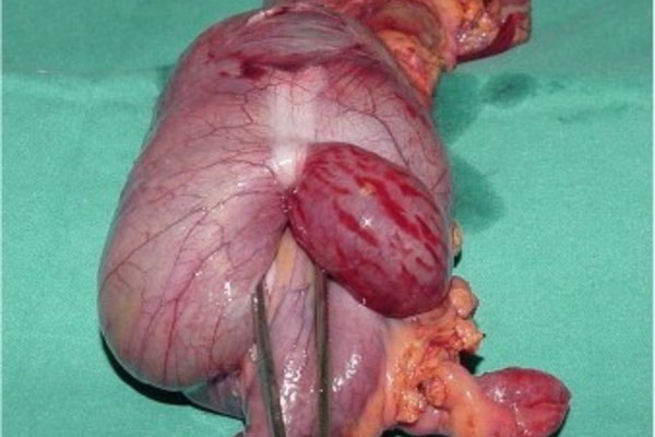 Benh hiem gap o nguoi lon nen rat de bi bo sot-Hinh-2