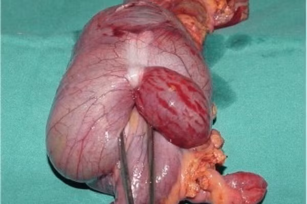 Benh hiem gap o nguoi lon nen rat de bi bo sot-Hinh-2