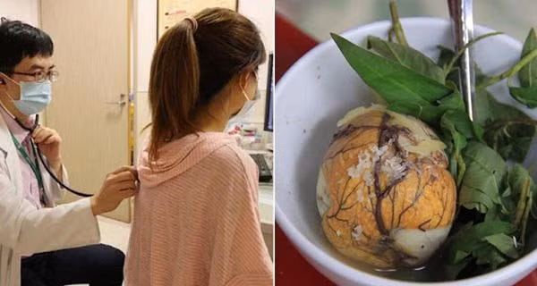 Trung vit lon giau dinh duong nhung rat doc voi 7 nguoi nay