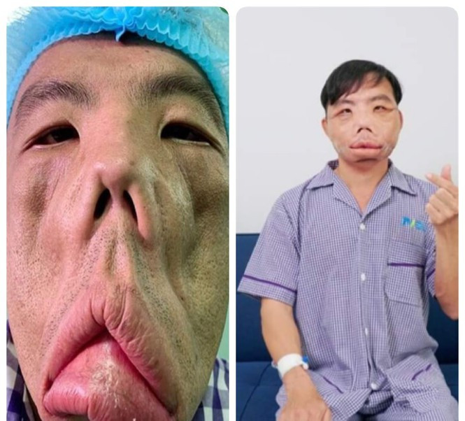 Ngắm diện mạo mới của chàng trai có gương mặt quỷ Ngam dien mao moi cua chang trai co guong mat quy