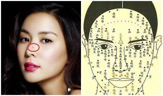 Nguoi co not ruoi o 4 vi tri nay tren khuon mat lam chu tai loc