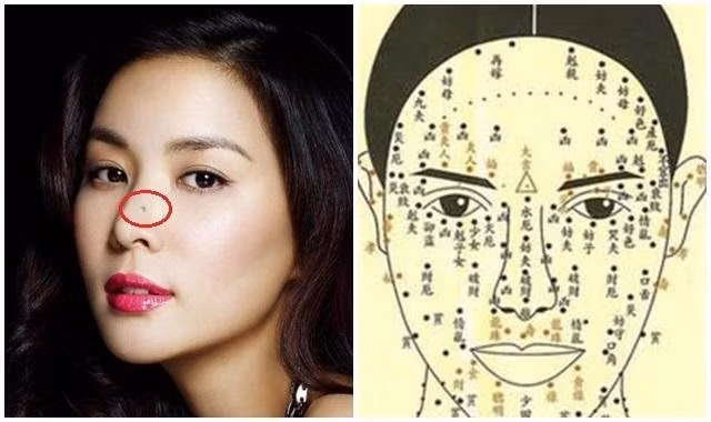 Nguoi co not ruoi o 4 vi tri nay tren khuon mat lam chu tai loc