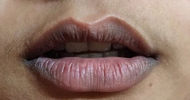 Nguoi co suc khoe kem, tuoi tho ngan thuong co 4 cai den tren co the