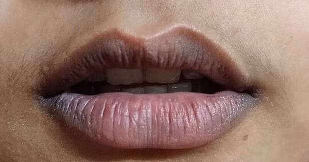 Nguoi co suc khoe kem, tuoi tho ngan thuong co 4 cai den tren co the