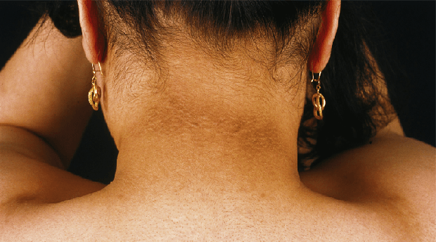 Nguoi co suc khoe kem, tuoi tho ngan thuong co 4 cai den tren co the-Hinh-2