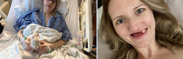 Nghi chi bi dau rang, di kham moi biet minh mac ung thu-Hinh-2