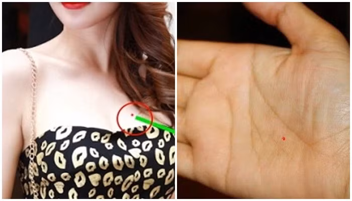 Phu nu co not ruoi tai vi tri nay, chua toi 40 da thanh ba chu