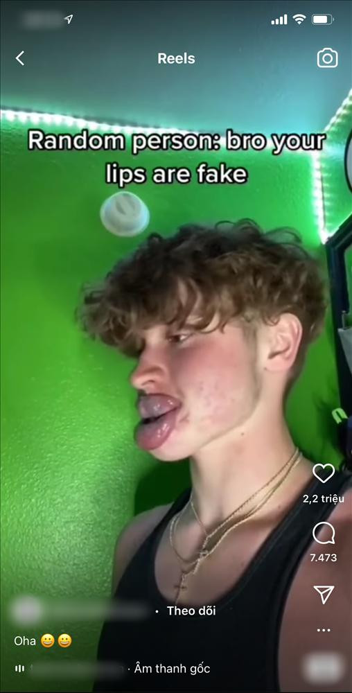 hông chỉ nữ giới mà nam giới cũng lũ lượt đu theo trào lưu này.