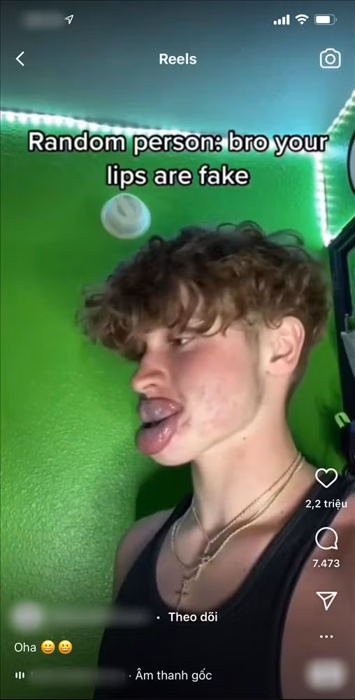 Không chỉ nữ giới mà nam giới cũng lũ lượt đu theo trào lưu này.