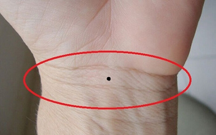 Ai so huu 6 not ruoi nay trong ban tay, tien tieu ca doi khong het