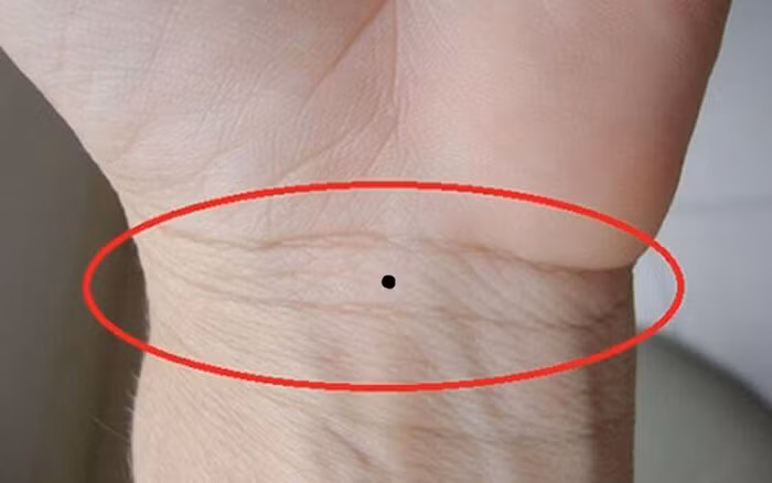 Ai so huu 6 not ruoi nay trong ban tay, tien tieu ca doi khong het