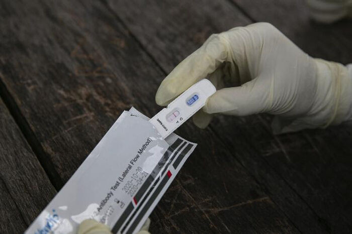 COVID-19 co the gay ra benh tuyen giap?