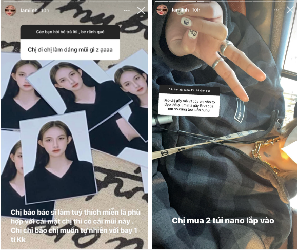 Ban gai tin don Decao cong khai phau thuat tham my-Hinh-3