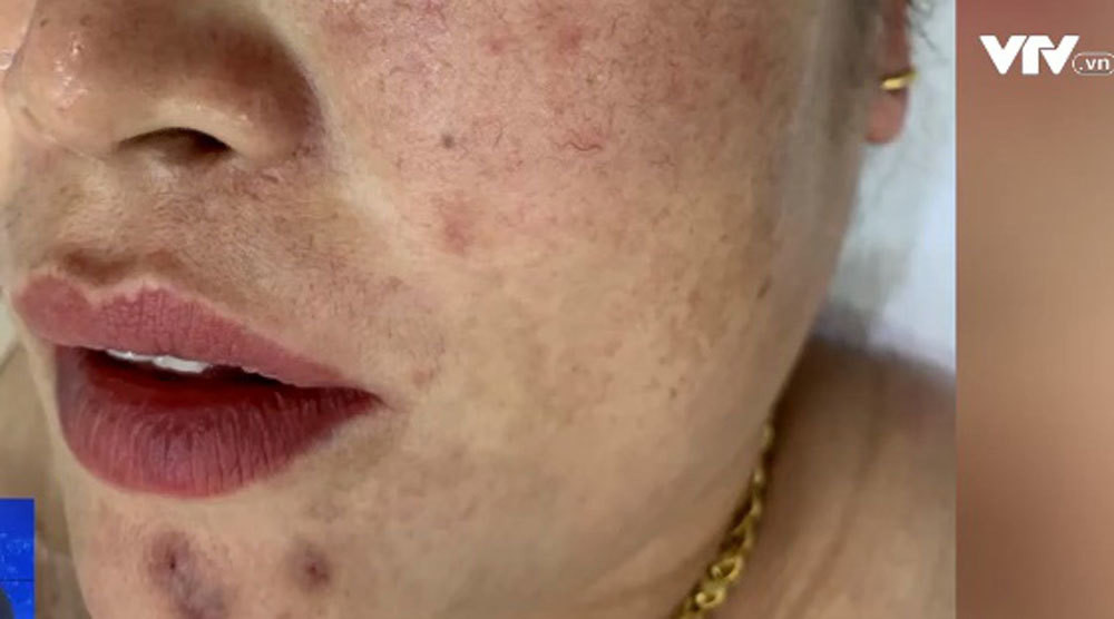 "Mê hồn trận" mỹ phẩm không nguồn gốc, người tiêu dùng "bấn loạn" ảnh 4