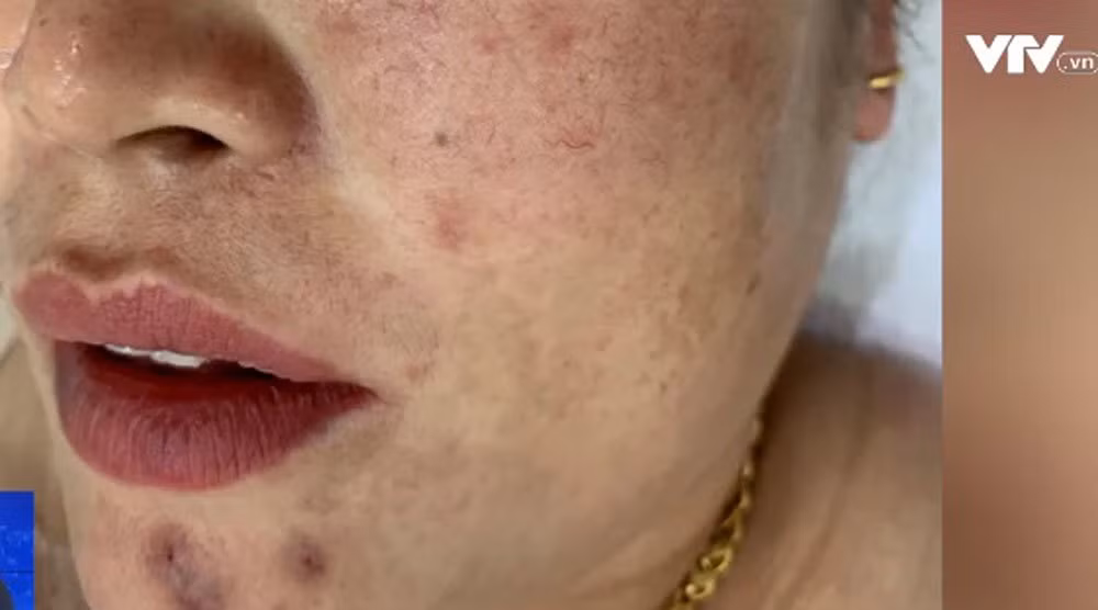 "Mê hồn trận" mỹ phẩm không nguồn gốc, người tiêu dùng "bấn loạn" ảnh 4