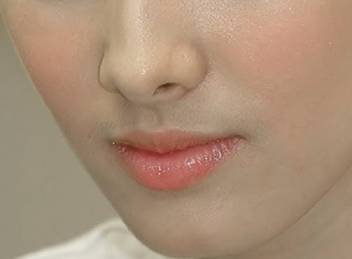 Người dễ mắc bệnh phụ khoa thường có 4 đặc điểm trên mặt - Hình 3 Nguoi de mac benh phu khoa thuong co 4 dac diem tren mat-Hinh-3