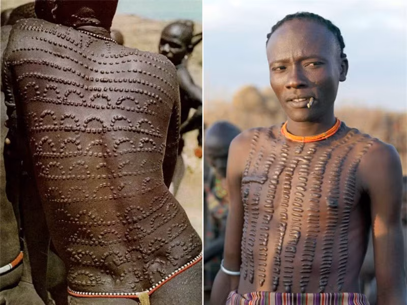 Những phong tục làm đẹp rùng rợn nhất trên thế giới ảnh 4 Những phong tục làm đẹp rùng rợn nhất trên thế giới ảnh 4