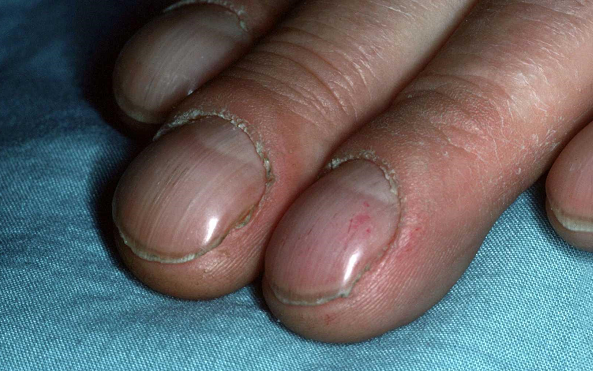 Tu kiem tra suc khoe cua phoi thong qua 6 dau hieu