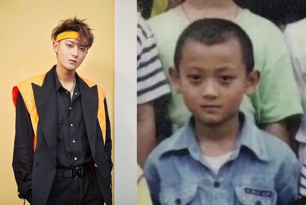 Hoàng Tử Thao số nhọ: Hết bị soi mắt thâm đến viêm cánh - Hình 2 Hoang Tu Thao so nho: Het bi soi mat tham den viem canh-Hinh-2