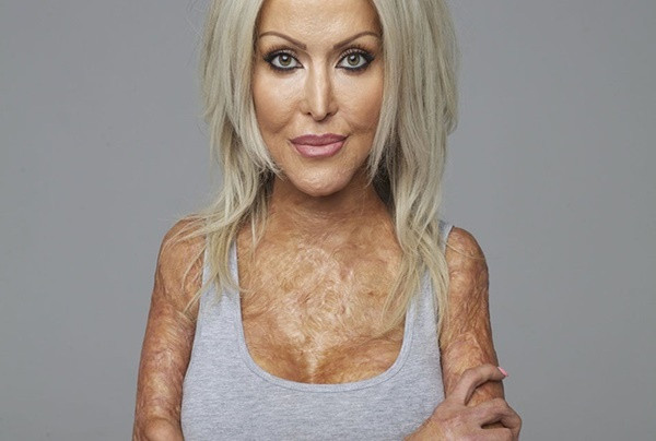 Cuối năm 2013, số phận lại trêu đùa với Dana khi cô được chẩn đoán mắc bệnh ung thư cổ tử cung. Dana đã chiến đấu với căn bệnh gần 4 năm. Trong khoảng thời gian này, cô đã trải qua thêm nhiều cuộc phẫu thuật và hóa trị. Cứ ngỡ những bi kịch xảy đến liên tiếp sẽ khiến cuộc đời Dana lao dốc nhưng ý chí mạnh mẽ không cho phép cô bỏ cuộc.