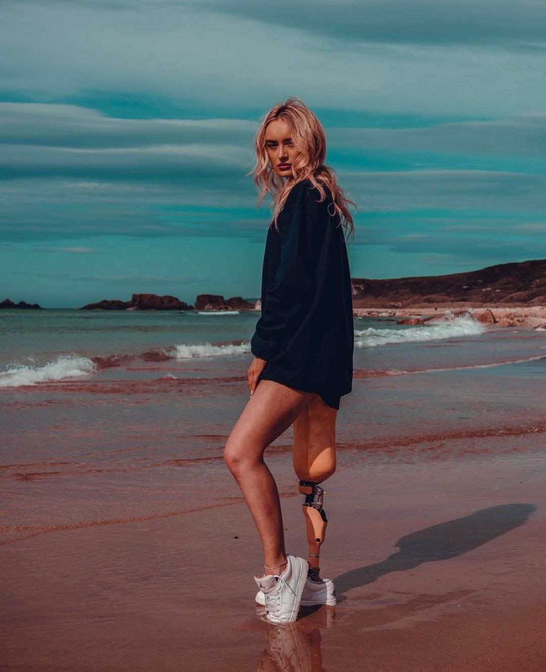  Sau khi phẫu thuật, cô đã tập đi bằng chân giả chỉ sau 10 ngày nằm viện. Thậm chí, cô còn tập đi bằng đôi giày cao gót. Chân giả của cô có thể được điều chỉnh chế độ để đi giày cao gót. Cô cho rằng điều này đã giúp ích khi thi hoa hậu.