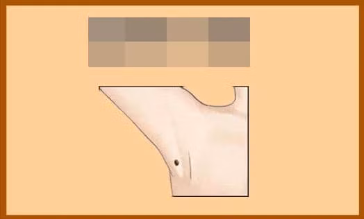 Not ruoi o 4 vi tri nay la qua may man! Neu ban co, xin chuc mung-Hinh-2