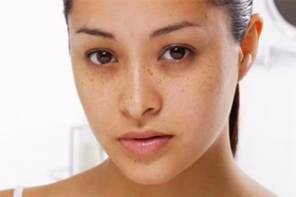 5 bộ phận chuyển sang màu đen chứng tỏ bệnh gan phát triển 5 bo phan chuyen sang mau den chung to benh gan phat trien