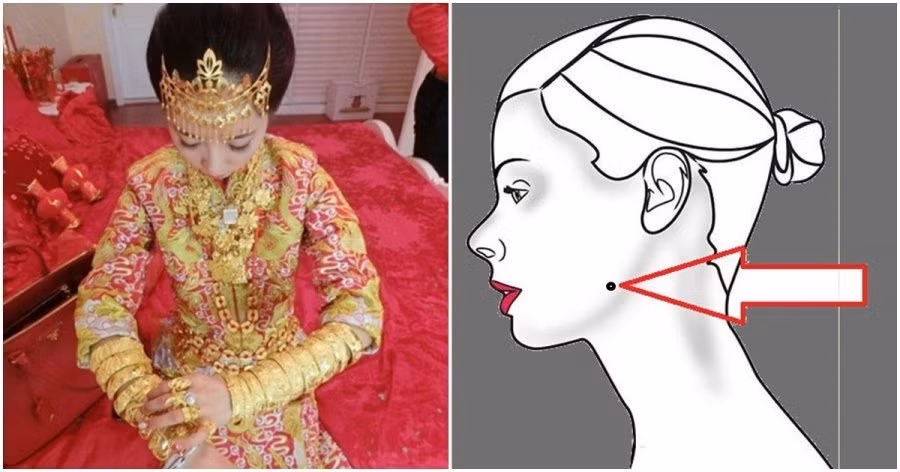 Vi tri vang cua not ruoi tai loc, du bao ca doi an khong het cua